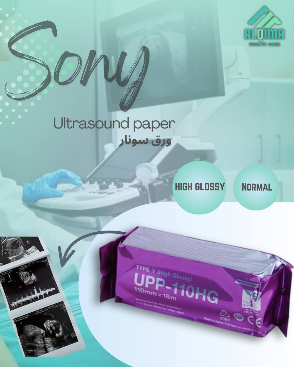 ورق سونار Sony